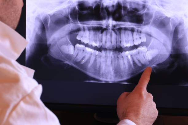 Best Tooth Infection Emergency Dentist  in Townsend, DE